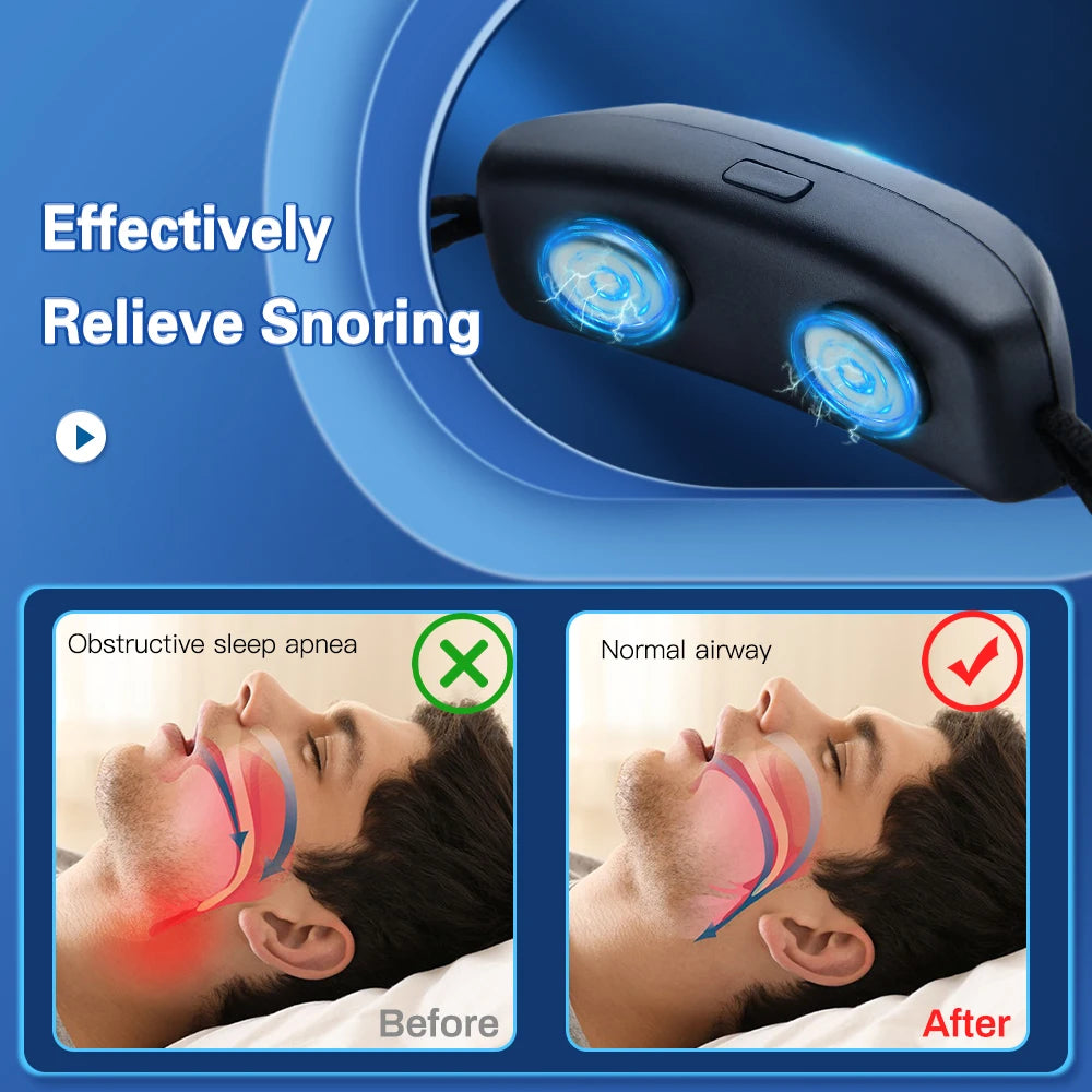 EMS Pulse Stop Snore Portable Comfortable Sleep